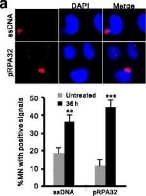 Immunocytochemistry/ Immunofluorescence: RPA2 [p Ser33] Antibody [NB100-544]